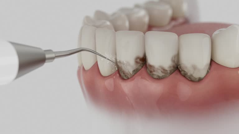 Trusted Teeth Cleaning And Checkup service in Old Greenwich, CT - Dentist Open Now